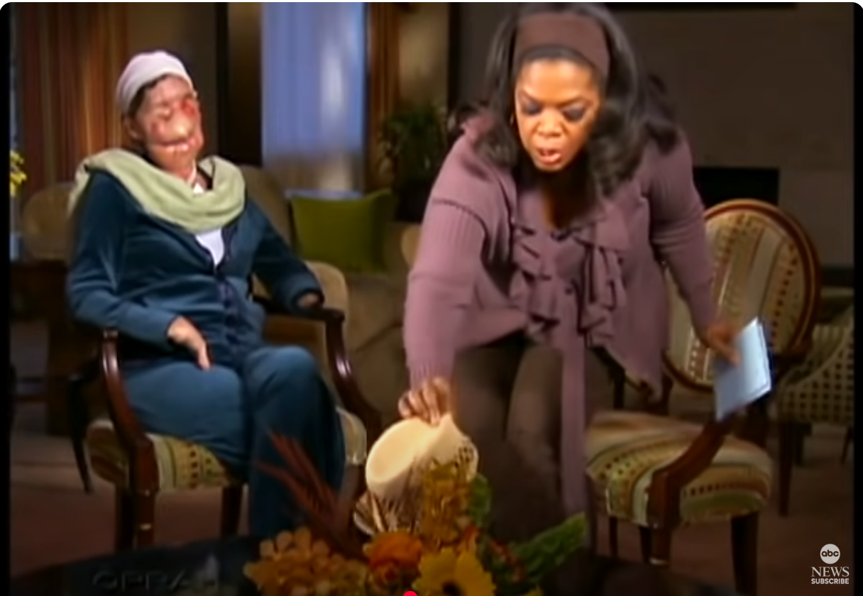 Oprah Winfrey nimmt Charla Nash den Schleier ab, zu sehen auf dem YouTube-Kanal von ABC News am 11. November 2009 | Quelle: YoTube/ABCNews