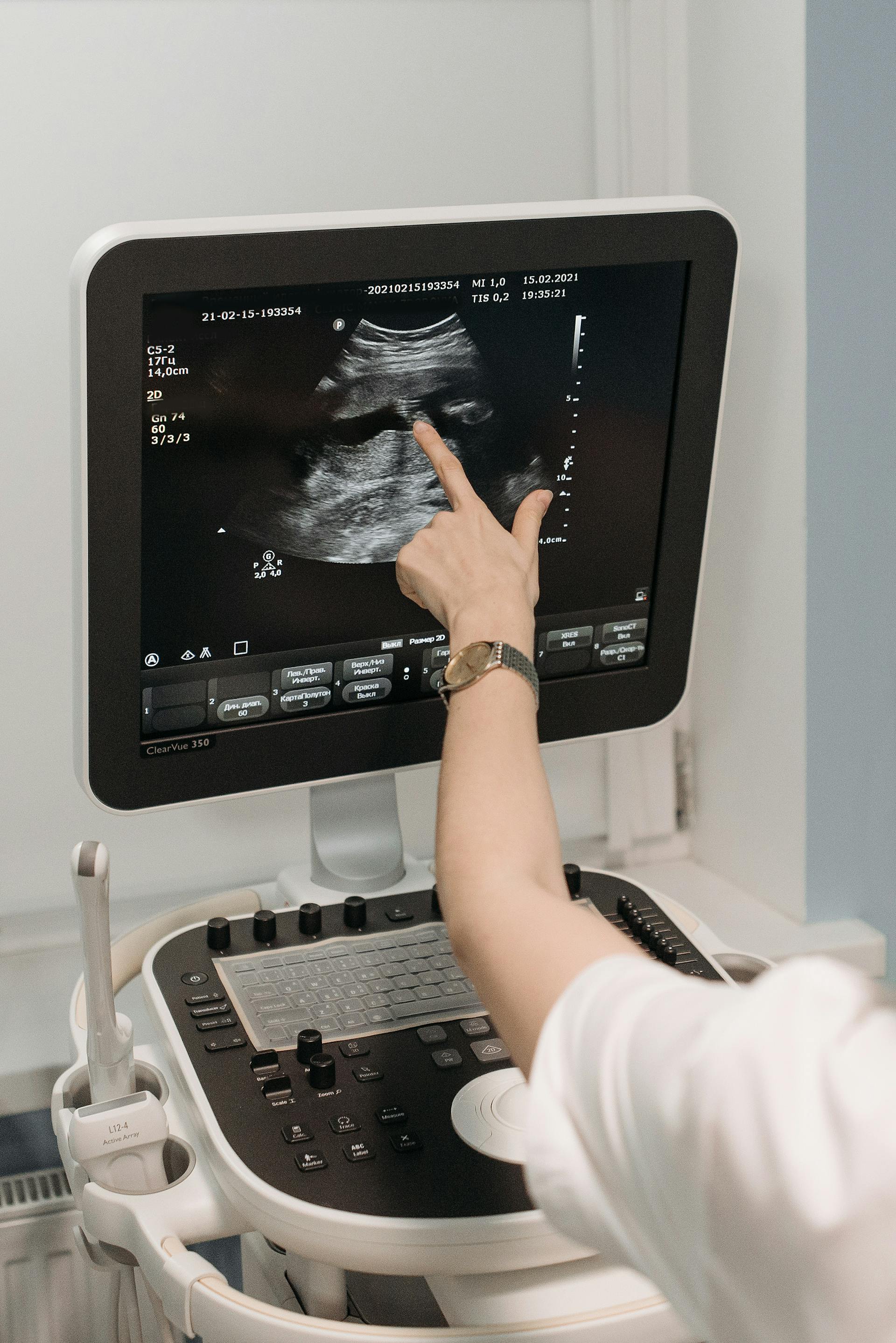 Ein Ultraschalldiagnostiker berührt den Ultraschallbildschirm | Quelle: Pexels