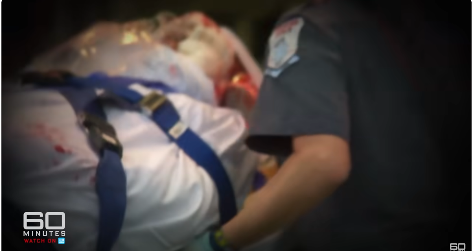 Charla Nash ist kaum noch am Leben, als sie in einen Krankenwagen gerollt wird, nachdem Travis sie angegriffen hat, vom 11. Juni 2025 | Quelle: YouTube/60MinutesAustralia