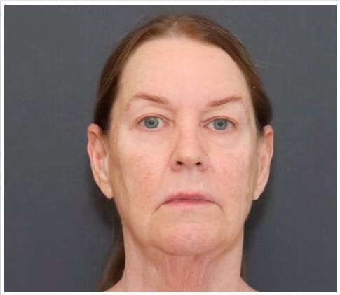 Tina Heaton vor einer kompletten Gesichtsverjüngung. | Quelle: TikTok/nayakplasticsurgery