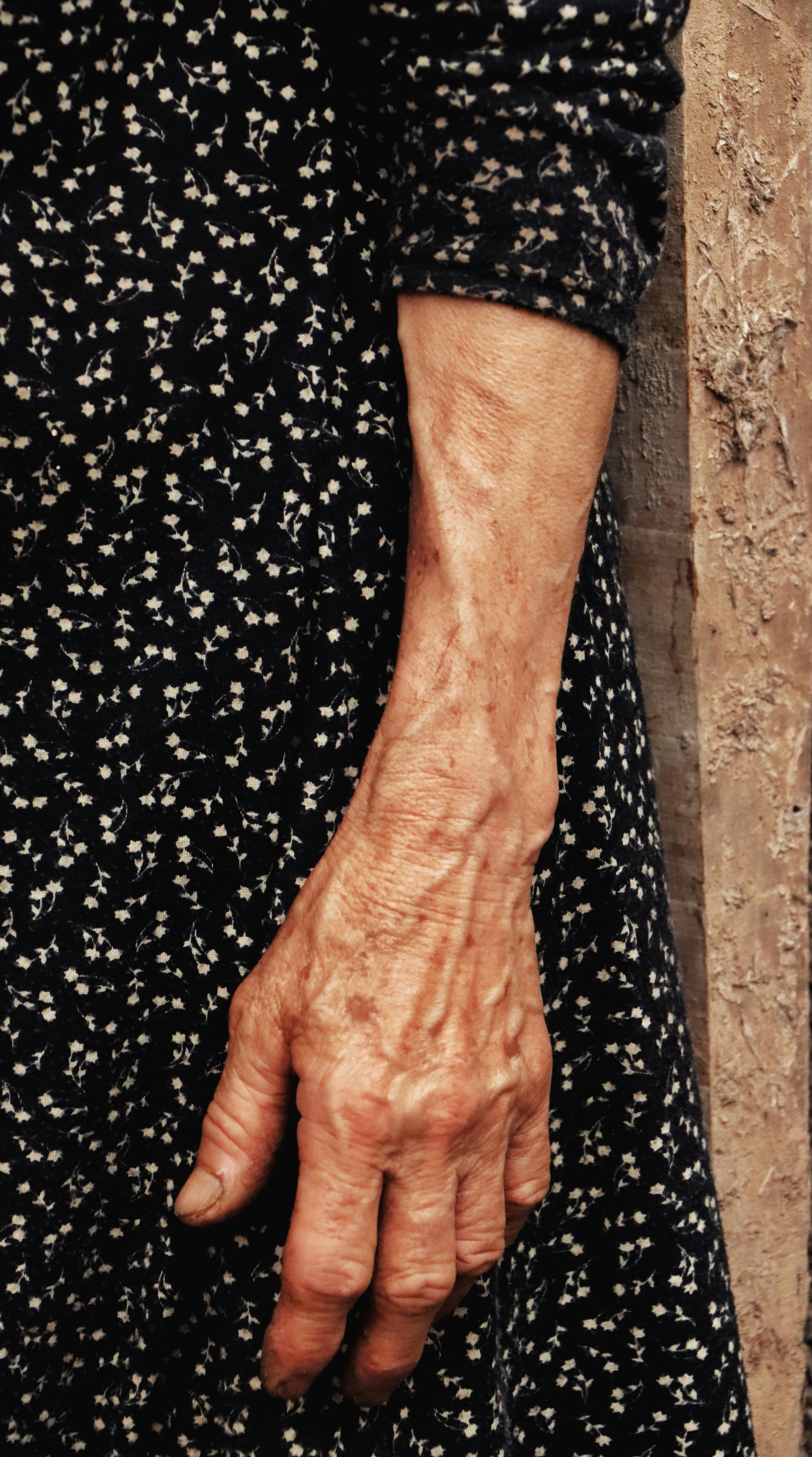 Der faltige Arm einer Frau | Quelle: Pexels
