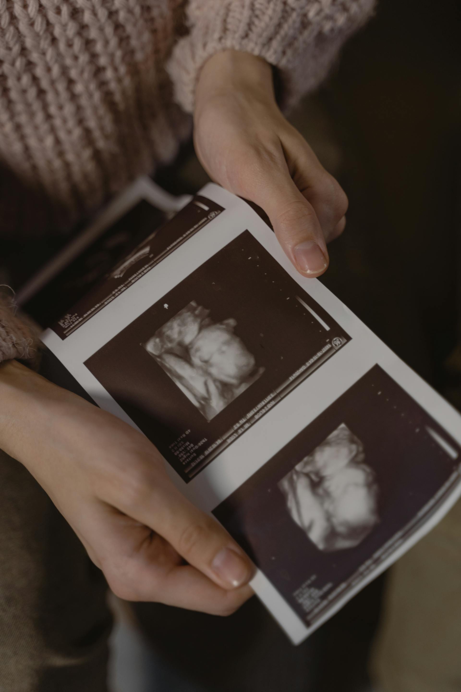 Eine Frau, die ein Ultraschallfoto in der Hand hält | Quelle: Pexels
