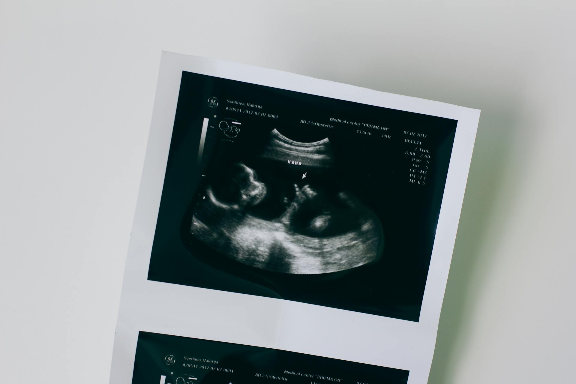 Nahaufnahme eines Sonogramms | Quelle: Pexels