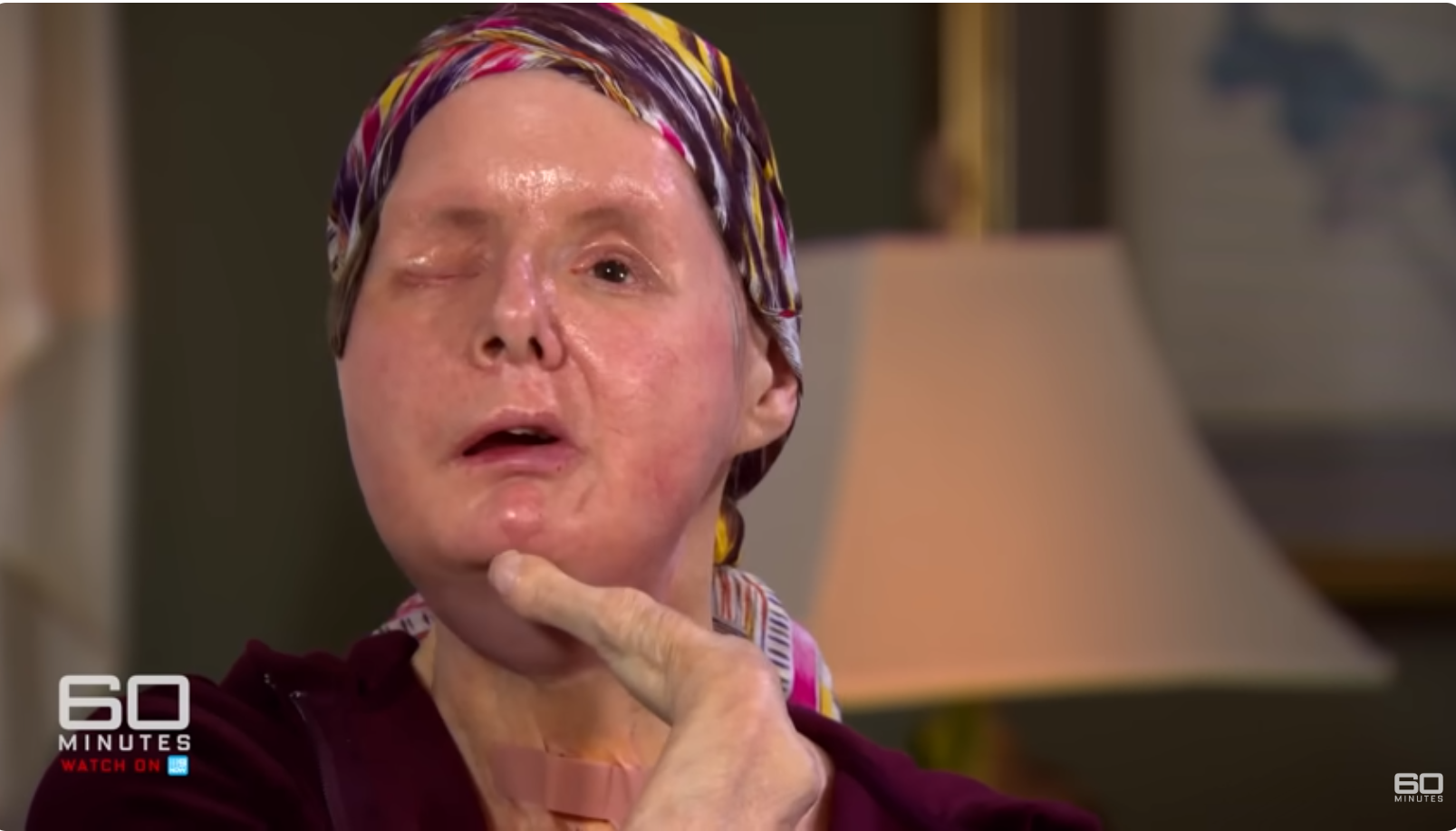 Charla Nash drückt während ihres Interviews mit 60 Minutes Australia vom 11. Juni 2025 ihre Dankbarkeit aus | Quelle: YouTube/60MinutesAustralia