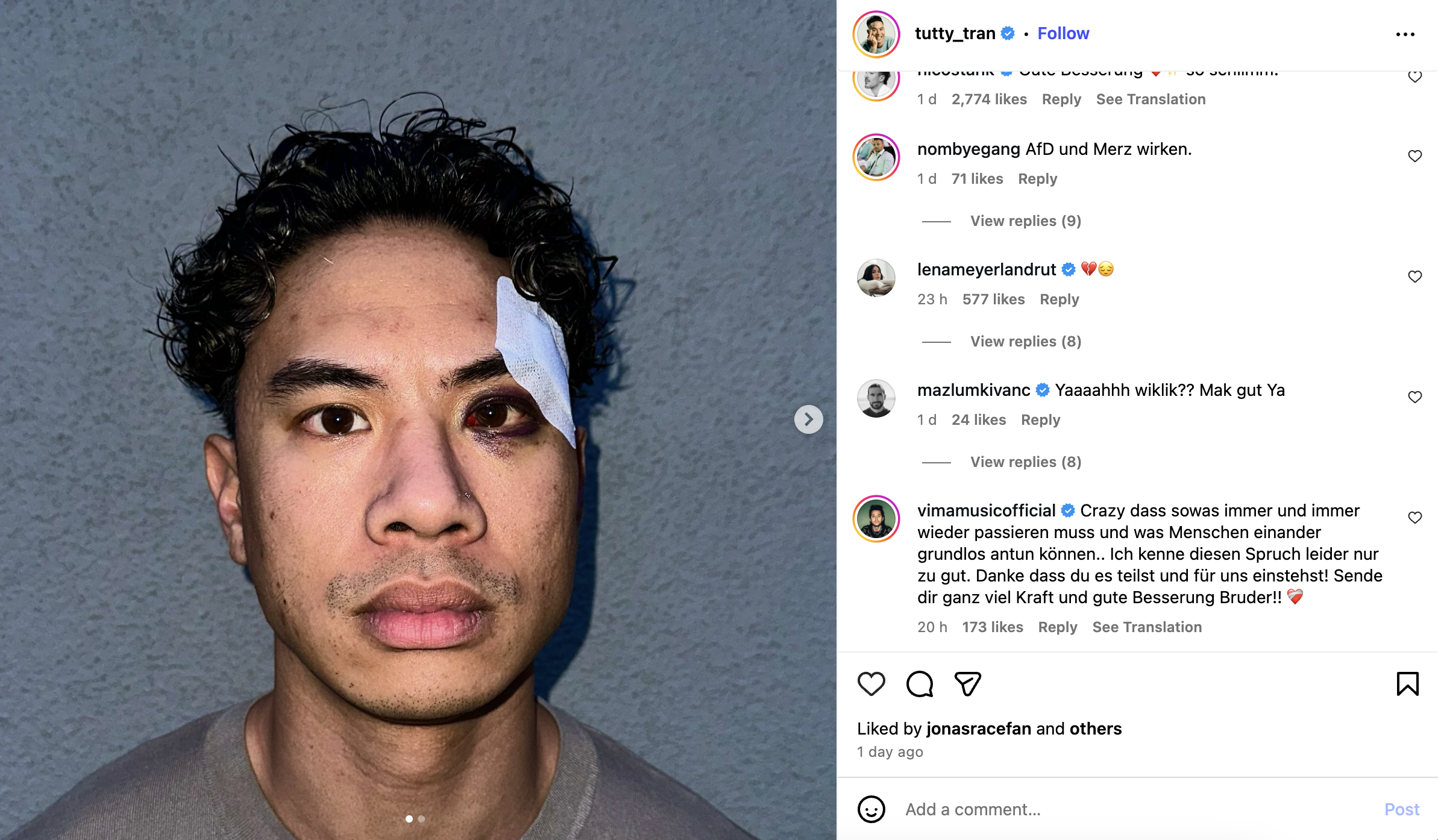 Screenshoot des Beitrags von Tutty Tran | Quelle: instagram.com/tutty_tran/