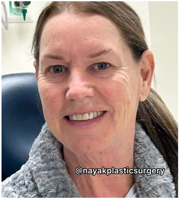 Tina Heaton lächelt, bevor sie sich einer Gesichtsverjüngungsoperation unterzieht. | Quelle: TikTok/nayakplasticsurgery
