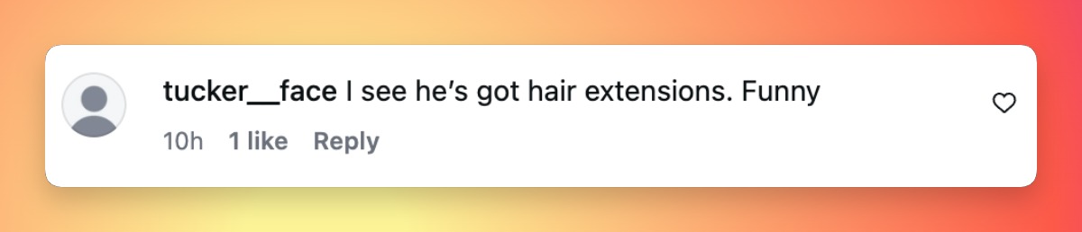 Als klare Fotos von diesem Abend im Internet die Runde machten, teilten Beobachter ihre Gedanken zu seinem neuen Look mit. | Quelle: Instagram/pagesix