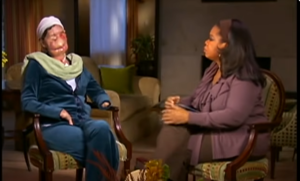 Charla Nash während ihres Interviews mit Oprah Winfrey, das auf ABC News am 11. November 2009 gezeigt wurde | Quelle: YoTube/ABCNews