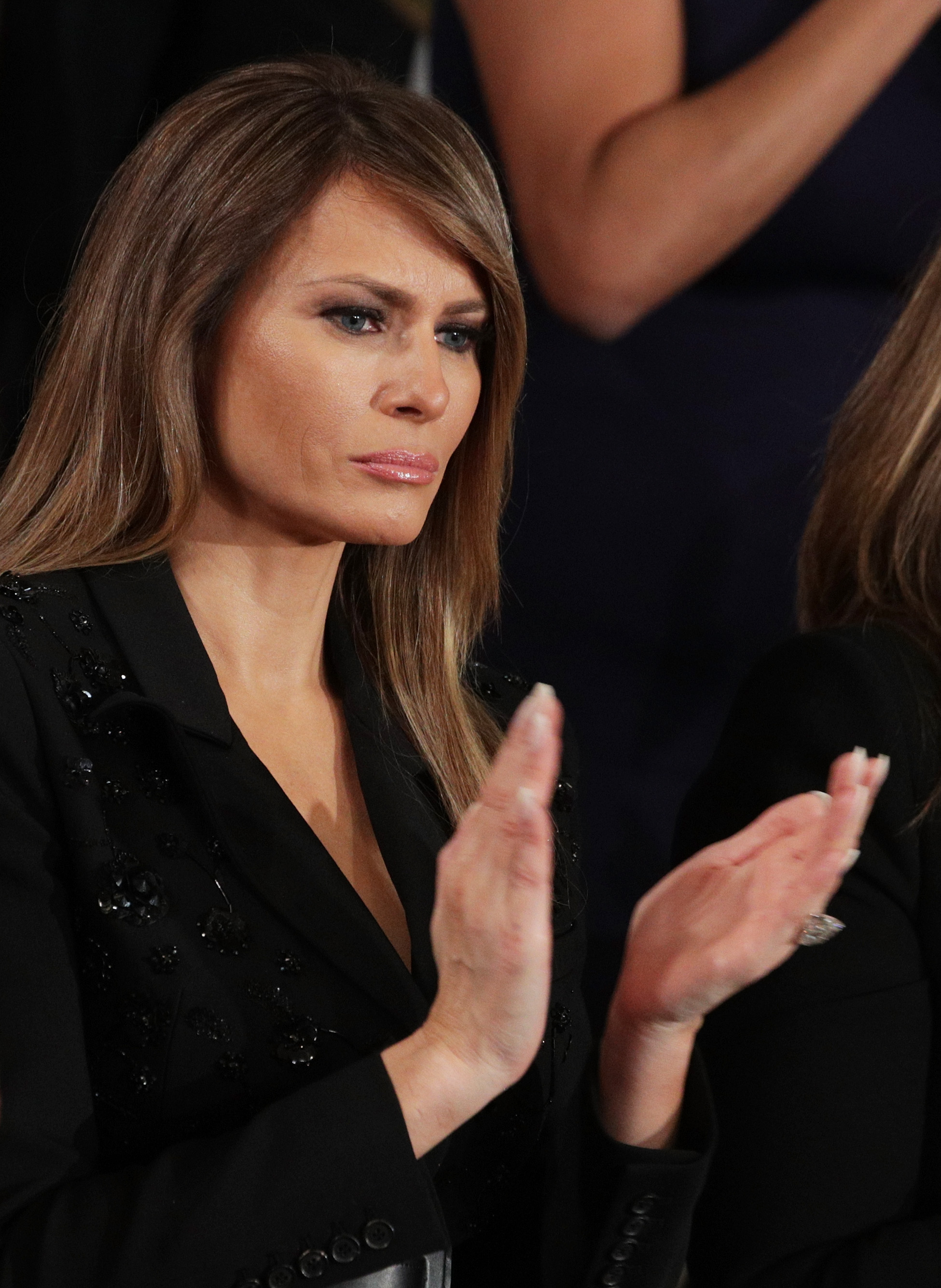 Dieses Foto aus dem Jahr 2017 zeigt Trump aus einem seitlichen Blickwinkel und hebt dabei die Gesichtskonturen hervor, die im Mittelpunkt der Expertenanalysen standen. Fachleute wiesen später beim Vergleich von Bildern aus verschiedenen Jahren auf Bereiche wie die Wangen, die Kinnlinie und die Augenpartie hin. | Quelle: Getty Images