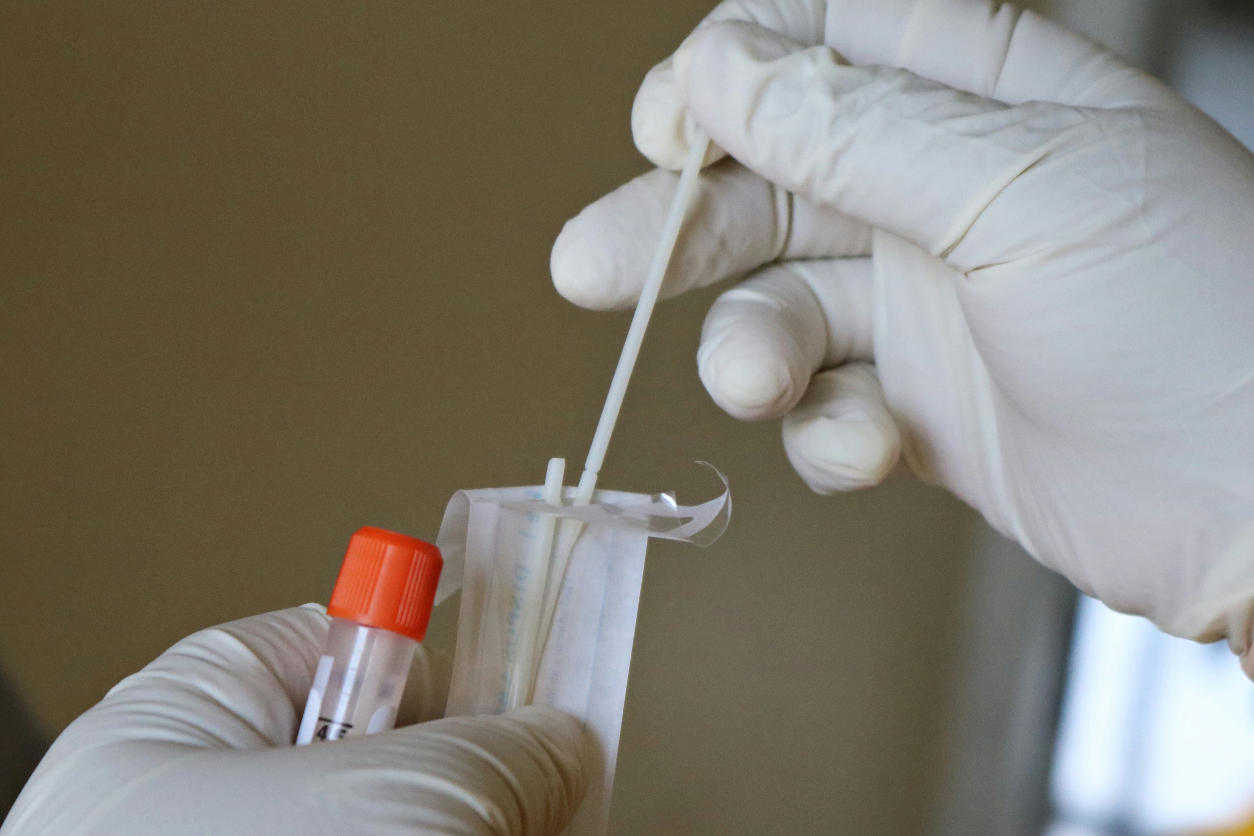Eine Person hält einen Abstrich für einen DNA-Test | Quelle: Unsplash